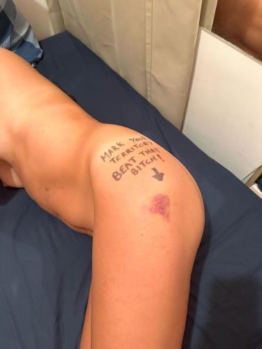 Pocahontas Azotar - Beat that Bitch - Part 1